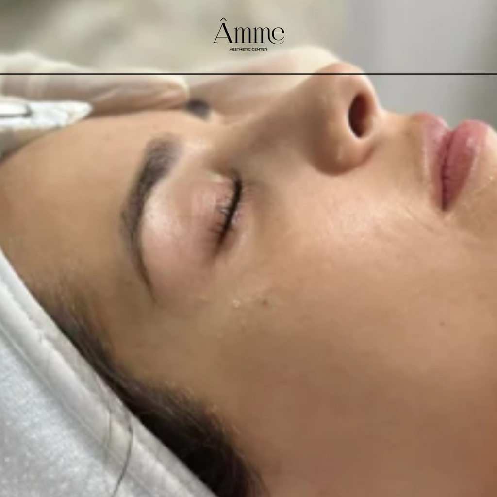 Aclarando el misterio del Dermaplaning: Cómo funciona y porqué deberías probarlo