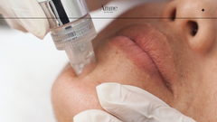 4 razones por las que deberías probar el tratamiento Hydrafacial