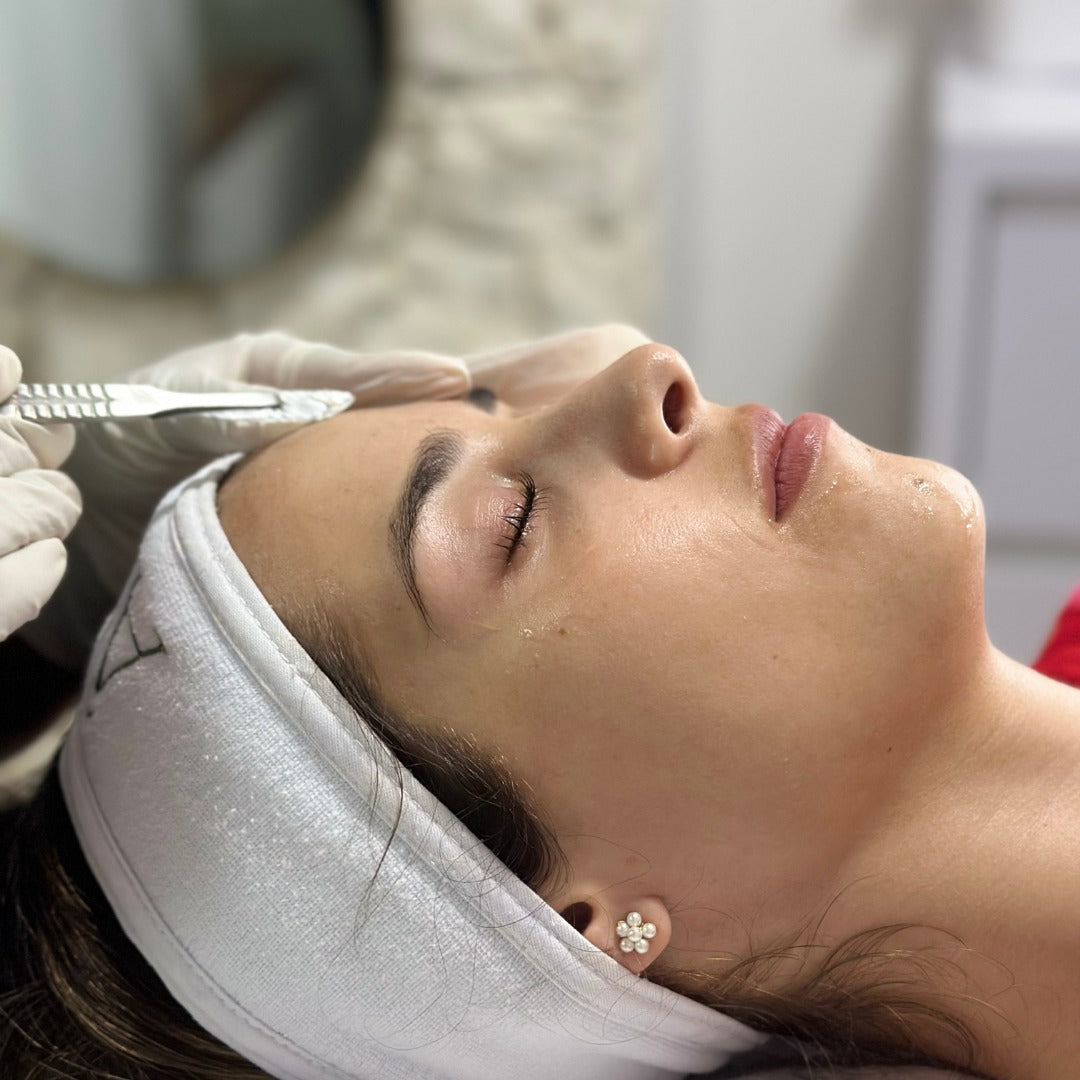 Dermaplaning