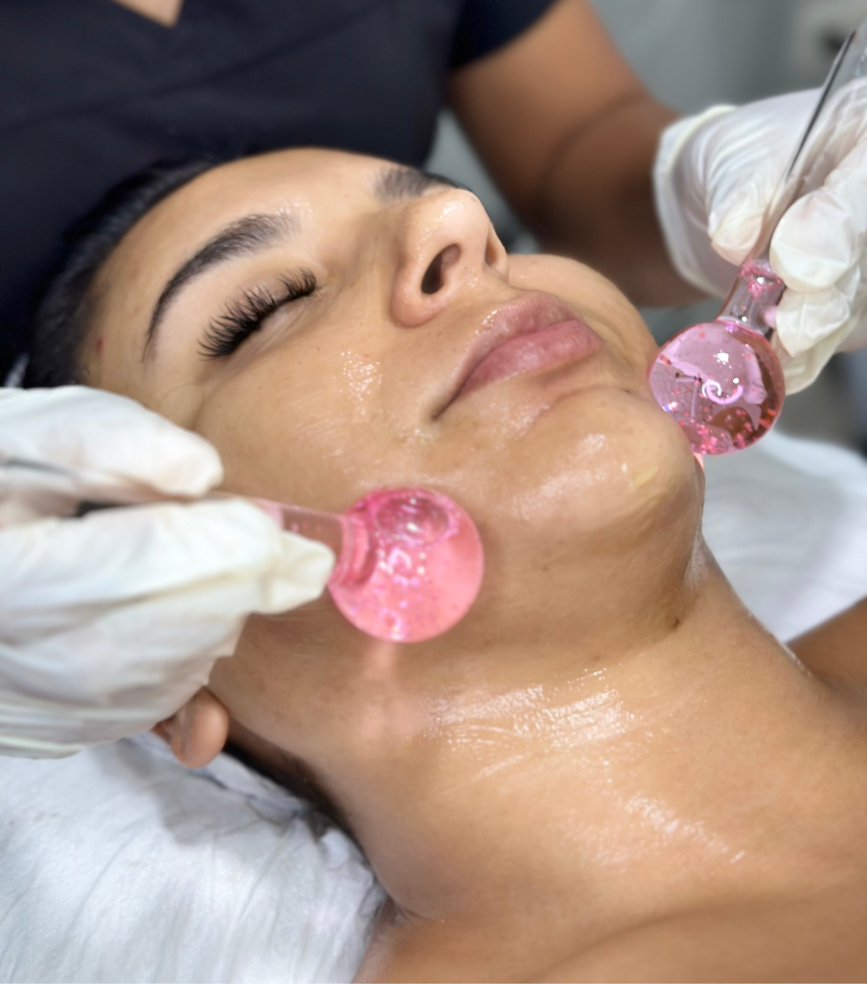 Dermaplaning